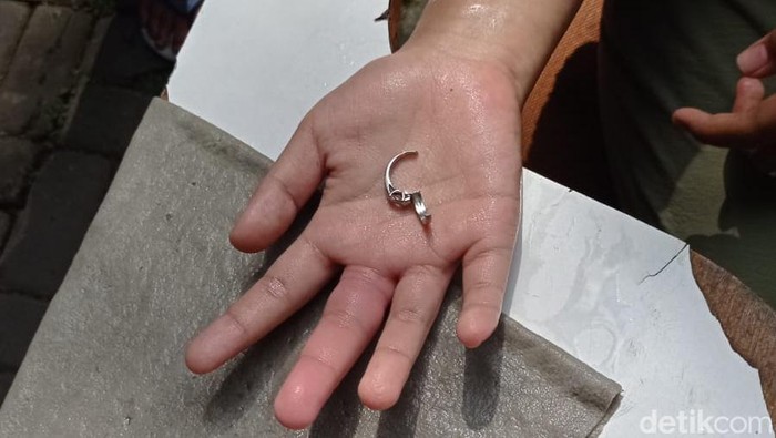 Disdamkar evakusi cincin dari jari warga Pasirjambu, Kabupaten Bandung