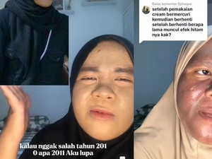 Viral Wajah Wanita Kaltim Menggosong, Bertahun-tahun Pakai Krim Merkuri