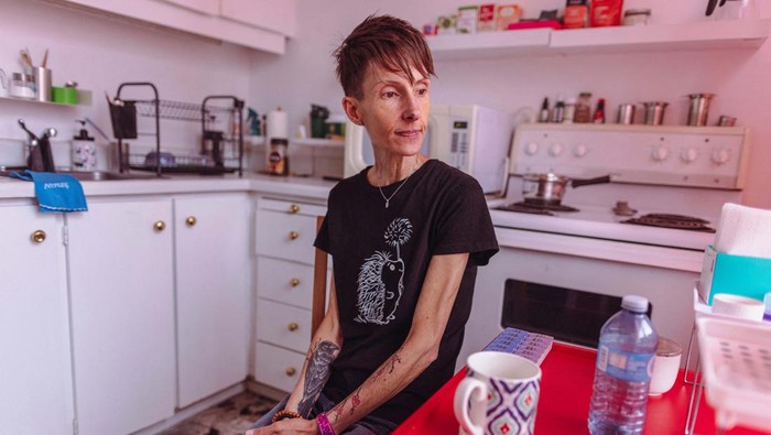 Lisa Pauli (47) duduk di kursi rumahnya di Toronto, Ontario, Kanada, Minggu (9/6/2023). Lisa mengatakan dia ingin mengajukan permohonan bantuan medis dalam keadaan sekarat (MAiD) ketika dia memenuhi syarat karena anoreksia parahnya.