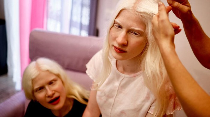 Sisters with albinism and professional models Matilde,17 and Angelica Aureli,15, sit on a bench in a park wearing hats and dark sunglasses, using an umbrella to protect their extra-sensitive skin and eyes from the sun, in Rome, Italy, July 12, 2023. Matilde and Angelica navigate unique obstacles as a heatwave grips Italy. The sisters who try not to go out before sunset, carry a special umbrella and sometimes use a high factor sunscreen to protect their skin from direct sun rays. Albinism is a disease caused by a mutation in genes and typically characterised by pale skin, light hair and poor vision. REUTERS/Yara Nardi
