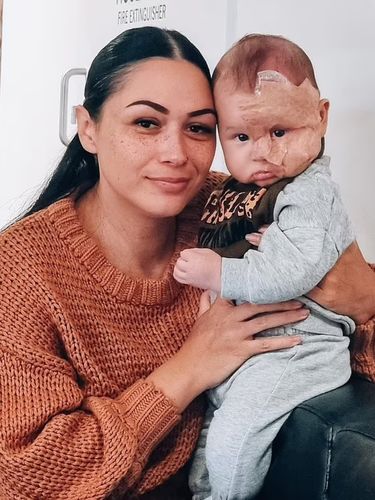 Brooke Atkins dan Kingsley Brooke Atkins, ibu yang di-bully karena laser wajah anaknya.