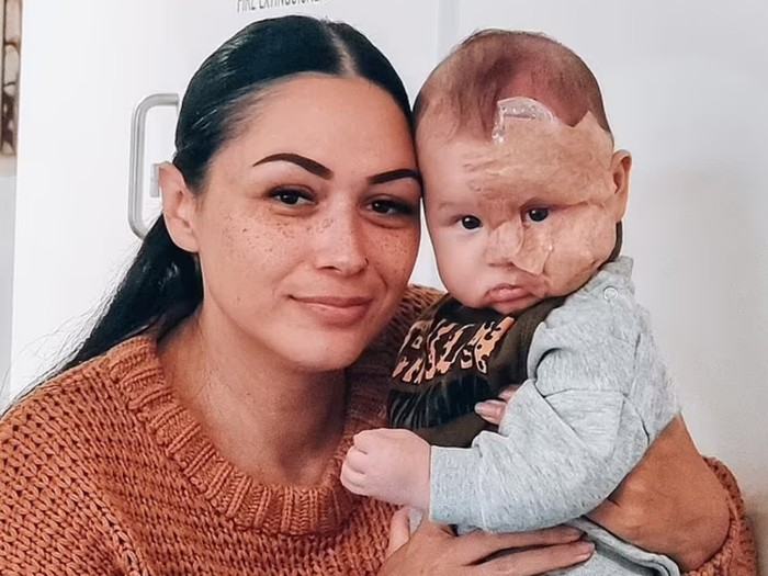 Brooke Atkins, ibu yang di-bully karena laser wajah anaknya.