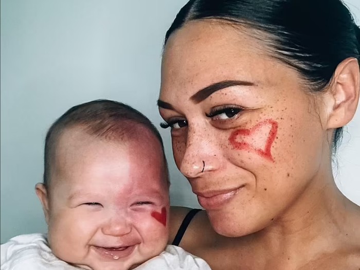 Brooke Atkins, ibu yang di-bully karena laser wajah anaknya.