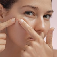 Jerawat Mendem Tak Kunjung Hilang? Kenali Penyebab & Cara Ampuh Mengatasinya