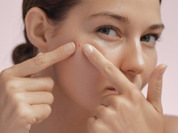 Jerawat Mendem di Dagu, Penyebab dan Cara Mengatasinya