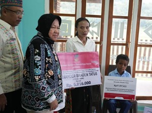 Mensos Bantu Pengobatan Anak Tumor Mata di Manggarai Timur
