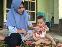 Bayi Berkaki 6 Tidak Punya Testis, Parasit di Bawah Perut Segera Dipisahkan