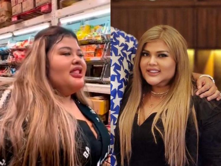 Kulineran Shindy Samuel, Selebgram yang Turun BB 34 Kg Usai Operasi Bariatri