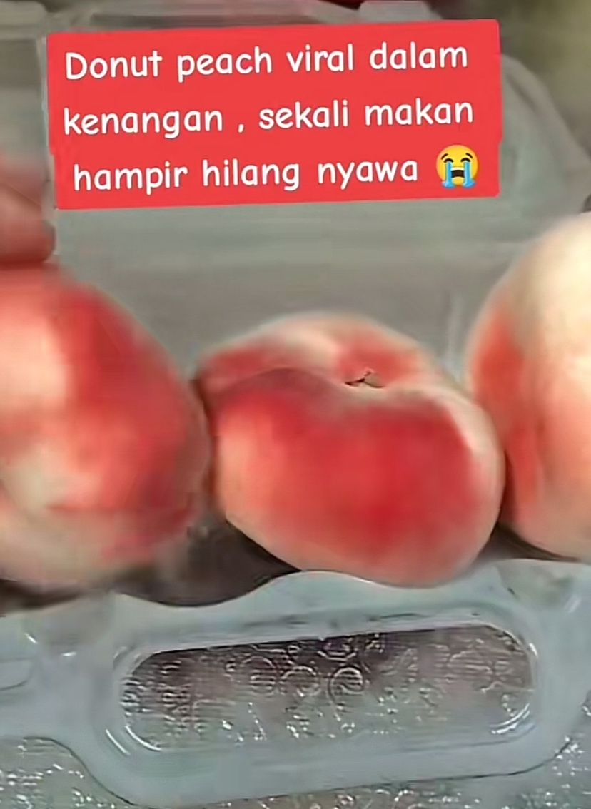 Niat Cicip Donat Unik, Wanita Ini Malah Masuk Rumah Sakit