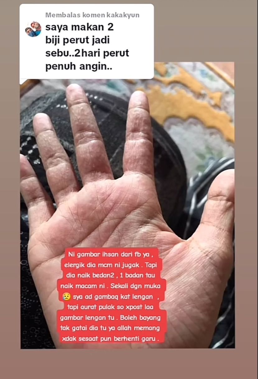 Niat Cicip Donat Unik, Wanita Ini Malah Masuk Rumah Sakit