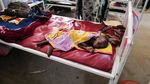 Potret Pilu Anak-anak Kekurangan Gizi Sudan Bertahan Hidup di Pengungsian