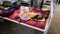 Sebagian besar anak para pengungsi itu mengalami malnutrisi parah.