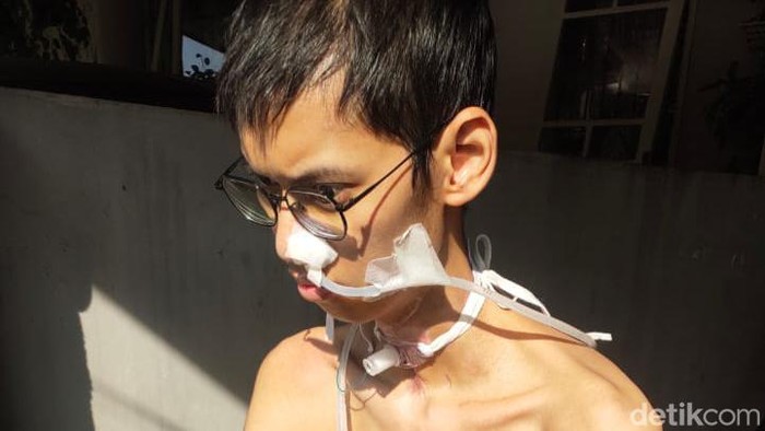 Sultan Rifat Alfatih (20) kini tak bisa hidup normal. Mahsiswa Universitas Brawijaya ini kini tak bisa bersuara usai lehernya terkena kabel yang menjuntai.