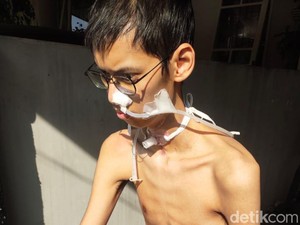 Nestapa Sultan Usai Leher Terjerat Kabel Menjuntai Kini Tak Bisa Bicara