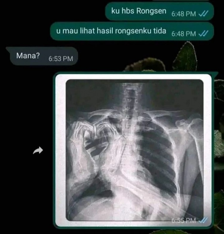 Aneh-aneh saja deh deretan chat berikut ini. Yang bacanya cuma bisa senyum atau geleng-geleng kepala saking absurdnya.