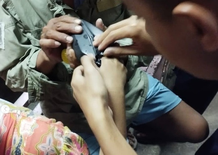 Tangan bocah kejepit spion motor.