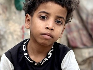 Penderitaan Anak-anak Yaman Jadi Korban Perang Bertahun-tahun