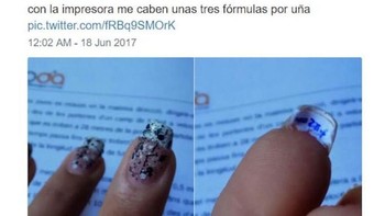 Contekan di balik kuku. Foto: istimewa