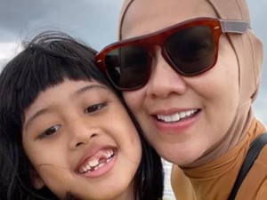 Mata Putri Venna Melinda Dilempar Batu di Sekolah, Begini Kronologinya