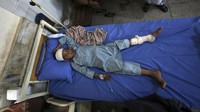 Para pejabat terkait menyatakan jumlah korban tewas dapat bertambah, karena 15 orang berada dalam kondisi kritis. AP Photo/Mohammad Sajjad.  