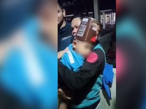 Momen Evakuasi Kaleng Biskuit Tersangkut di Kepala Balita di Tasikmalaya