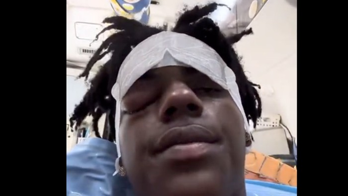 Youtuber IShowSpeed Kesakitan Parah gegara Cluster Headache, Kondisi Apa Itu?