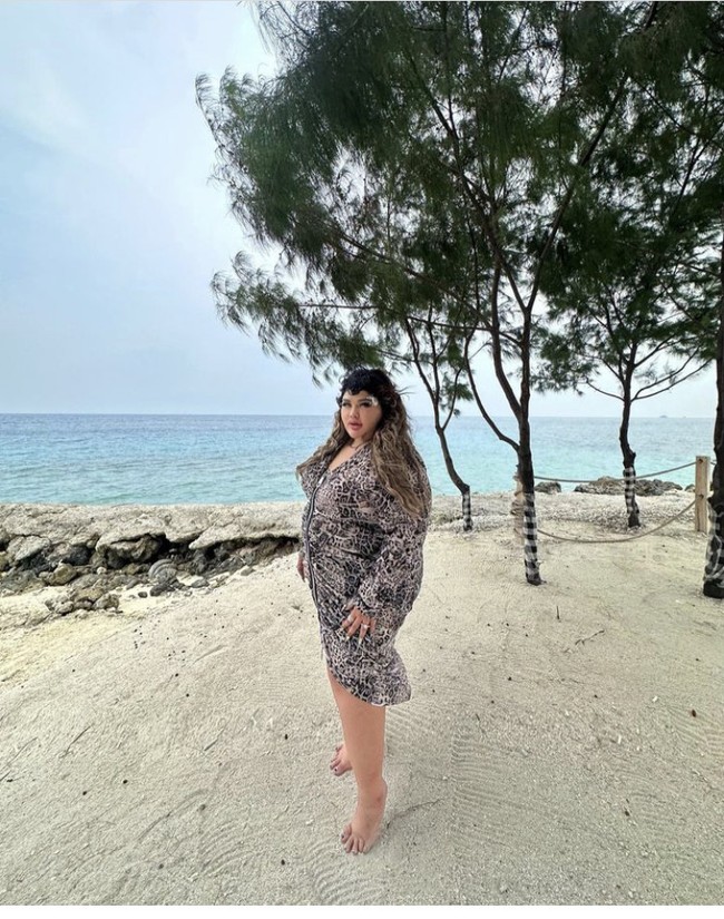  Shindy pun menyadari bahwa obesitas yang dialaminya tak baik bagi tubuh. Setelah melakukan berbagai program diet, dan tak membuahkan hasil, ibu satu anak ini memutuskan untuk menjalani operasi bariatrik. Foto: Instagram