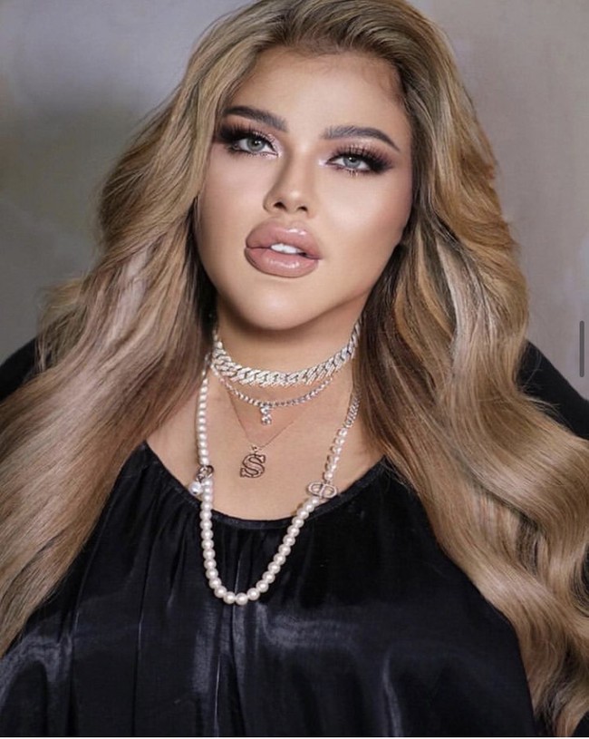 Pada Juni lalu, Shindy Samuel melakukan operasi untuk membatasi jumlah makanan yang dapat ditampung oleh lambung. Pembedahan yang juga pernah dilakukan Melly Goeslaw ini pun mulai membuahkan hasil. Foto: Instagram