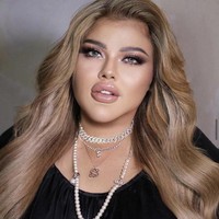 Pada Juni lalu, Shindy Samuel melakukan operasi untuk membatasi jumlah makanan yang dapat ditampung oleh lambung. Pembedahan yang juga pernah dilakukan Melly Goeslaw ini pun mulai membuahkan hasil. Foto: Instagram