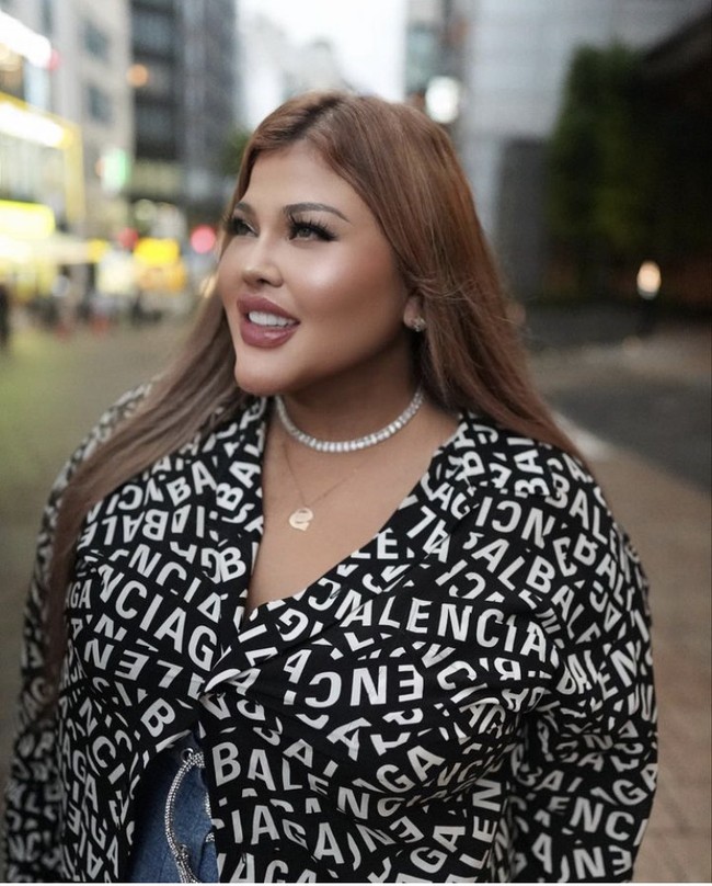 Sejak operasi bariatrik, selebgram yang memiliki 536 ribu lebih pengikut ini tak bisa lagi makan banyak. Shindy pun mengaku hanya bisa makan dua sampai tiga sendok saja, jika dipaksakan akan muntah. Foto: Instagram