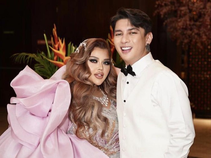 Transformasi Shindy Samuel Usai Operasi Pengecilan Lambung