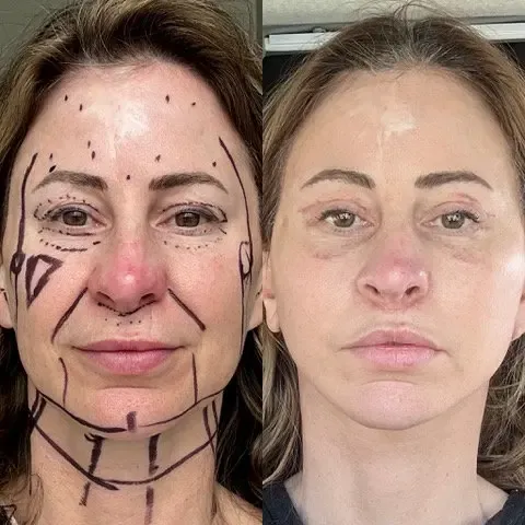 Kelly Beasley Kelly Beasley