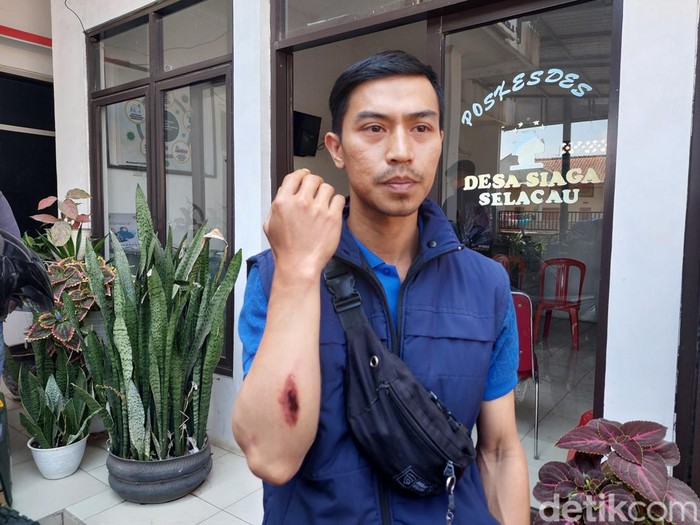 Korban Tabrak Lari Angkot di KBB Tunjukan Luka Usai Kejadian