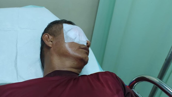 Mata guru SMA dikatapel orang tua siswa yang kesal anaknya dipukul ketahuan merokok