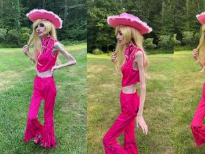 Kisah YouTuber Eugenia Cooney Idap Anoreksia, Tubuh Kurusnya Jadi Sorotan