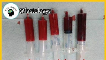 Perbedaan warna darah berdasarkan level oksigen. Foto: Instagram/factologys