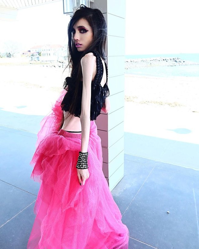 Ayo keluarkan dia dari IG dan YouTube. Ini tidak bagus. Anak-anak bisa melihat ini, Ini sangat bisa mempengaruhi jutaan anak. Akunnya seharusnya ditutup dan dia dirawat di rumah sakit, tulis yang lain. Foto: Instagram