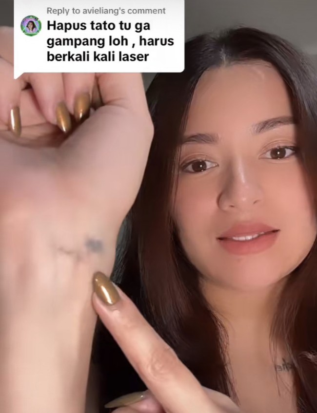Ibu satu anak ini terlihatkan memamerkan tato di beberapa bagian tubuhnya, seperti di pergelangan tangan, lengan, dan jarinya. Ia pun menjelaskan bagaimana perjuangan dirinya untuk menghapus tato-tato tersebut. Foto: Instagram