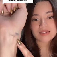 Ibu satu anak ini terlihatkan memamerkan tato di beberapa bagian tubuhnya, seperti di pergelangan tangan, lengan, dan jarinya. Ia pun menjelaskan bagaimana perjuangan dirinya untuk menghapus tato-tato tersebut. Foto: Instagram