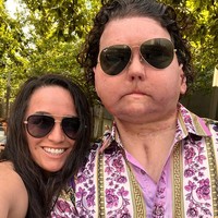 Pria 24 tahun itu mendapatkan transplantasi wajah ganda dari seorang donor yang berusia 48 tahun. Sebanyak 20 kali operasi plastik telah dilalui Joe. Foto: dok. Instagram/@jessicakoby