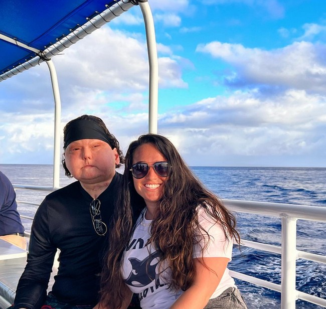 “Tidak terasa aneh diberi wajah dari seseorang yang usianya hampir dua kali lipat dari usia saya karena saya benar-benar siap untuk memulai hidup saya lagi. Inilah saya sekarang dan saya menyadarinya dengan sangat cepat, ungkap Joe seperti dikutip dari NY Post. Foto: dok. Instagram/@jessicakoby