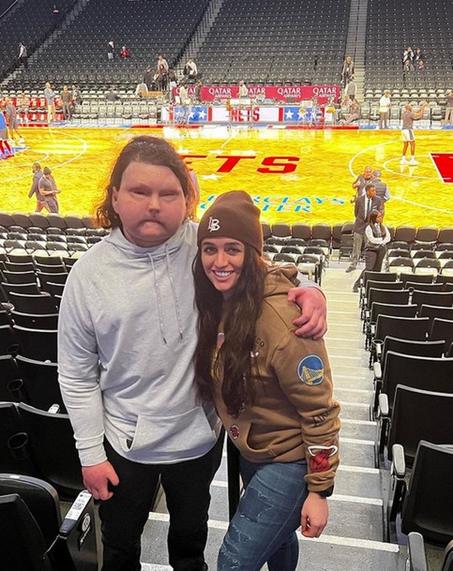 Jessica mengaku bahwa dia terpikat karena kepositifan dan kekuatan Joe yang luar biasa di tengah cobaannya yang berat. Karakter tersebut belum pernah Jessica lihat di banyak penerima transplantasi lainnya.Foto: dok. Instagram/@jessicakoby