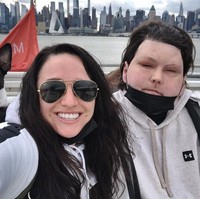 Jessica sering membantu Joe dengan tugas sehari-hari yang tidak dapat ditangani secara mandiri karena mobilitas tangan dan jarinya yang terbatas. Namun, terlepas dari tantangan ini, Joe tetap mandiri, bahkan belajar mengemudi lagi, yang membantunya mendapatkan kembali kebebasannya. Foto: dok. Instagram/@jessicakoby