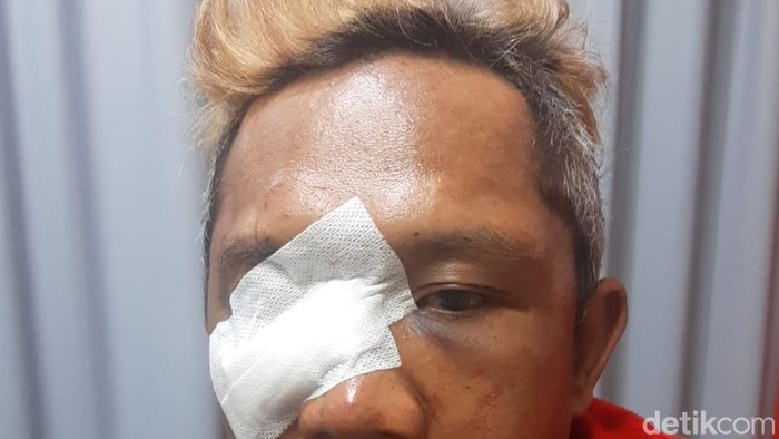 Kondisi korban pengeroyokan di Mojokerto.