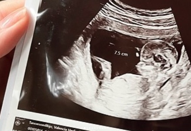 Dalam pesta tersebut sudah diungkap ke publik bahwa Hary Tanoesoedibjo dan Liliana Tanoesoedibjo akan dikaruniai cucu perempuan. Congratulation Kevin & Valen🙏. Kevins Birthday Celebration & Gender Reveal. coming soon baby A January 2024. its a girl, tulis Liliana di Instagram. Foto: Instagram @valenciatanoe