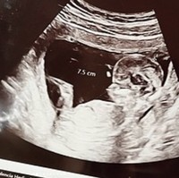 Dalam pesta tersebut sudah diungkap ke publik bahwa Hary Tanoesoedibjo dan Liliana Tanoesoedibjo akan dikaruniai cucu perempuan. Congratulation Kevin & Valen🙏. Kevins Birthday Celebration & Gender Reveal. coming soon baby A January 2024. its a girl, tulis Liliana di Instagram. Foto: Instagram @valenciatanoe