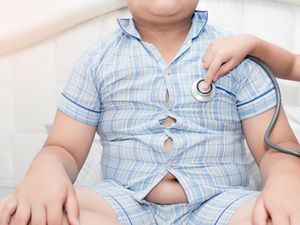 Ahli: Obesitas Tak Melulu soal Terlalu Banyak Makan