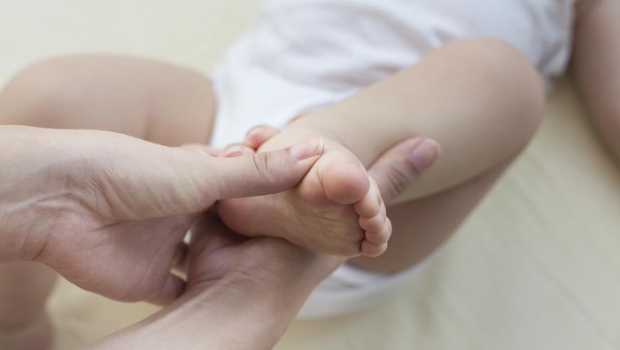 Ilustrasi Kaki Bayi Pengkor