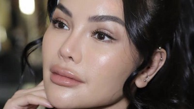 Potret Wajah Baru Nikita Mirzani Usai Operasi Plastik yang Bikin Pangling