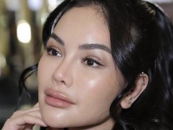Potret Wajah Baru Nikita Mirzani Usai Operasi Plastik yang Bikin Pangling